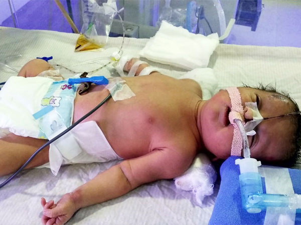 Help Lakshmi In Saving Her Newborn! Help Lakshmi In Saving Her Newborn!