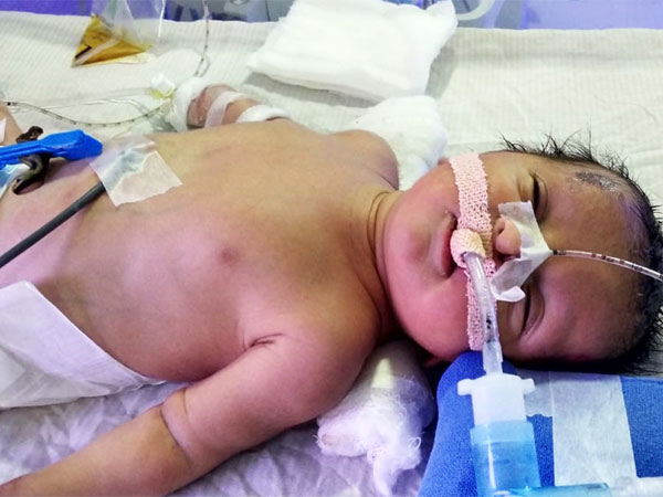 Help Lakshmi In Saving Her Newborn! Help Lakshmi In Saving Her Newborn!