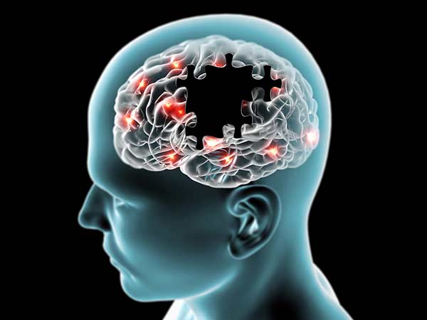 today- is world alzheimers day today- is world alzheimers day
