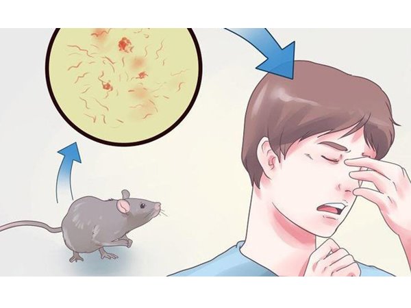 Youth dead in Coimbatore due to rat fever Youth dead in Coimbatore due to rat fever