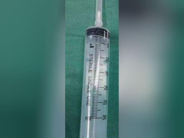 சிரமப்பட்டு ஆபரேஷன்