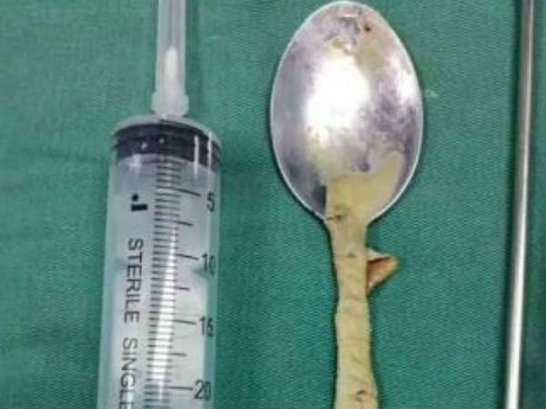 பேச முடியலையாம்