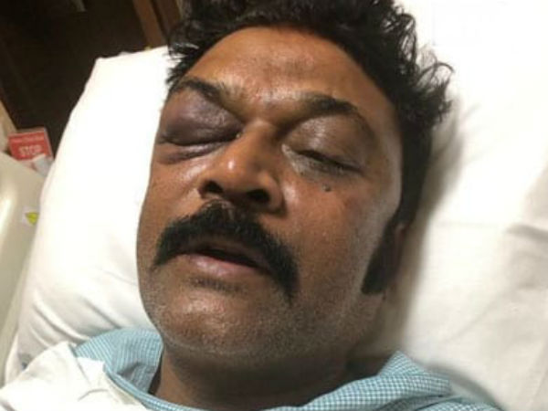 ஆனந்த் சிங் மீது தாக்குதல்