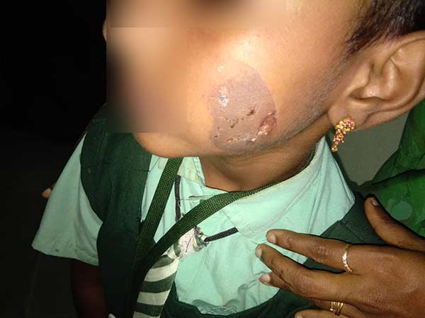 father tortures own kid and arrested father tortures own kid and arrested