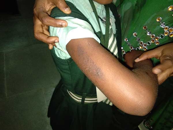father tortures own kid and arrested father tortures own kid and arrested