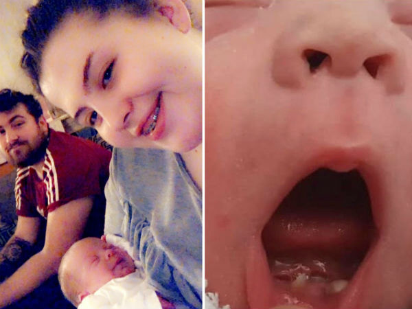 Miraculous baby born with front teeth .. wonder in UK hospital! Miraculous baby born with front teeth .. wonder in UK hospital!