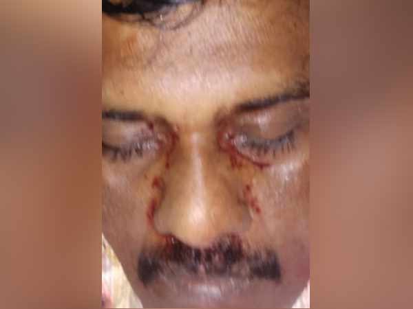 Rowdy hacked to death in madurai Rowdy hacked to death in madurai