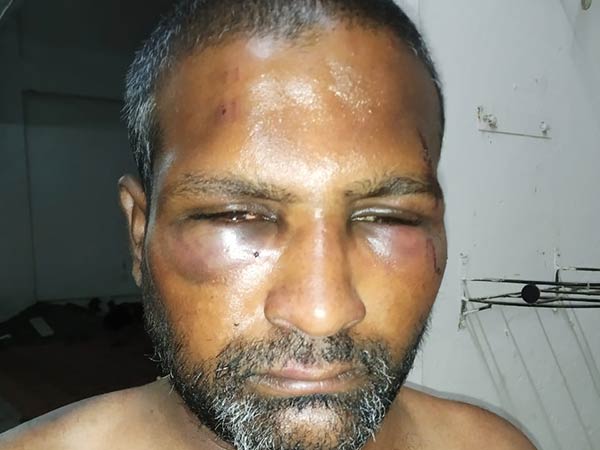 youth attacked by mlas brother youth attacked by mlas brother