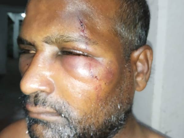 youth attacked by mlas brother youth attacked by mlas brother