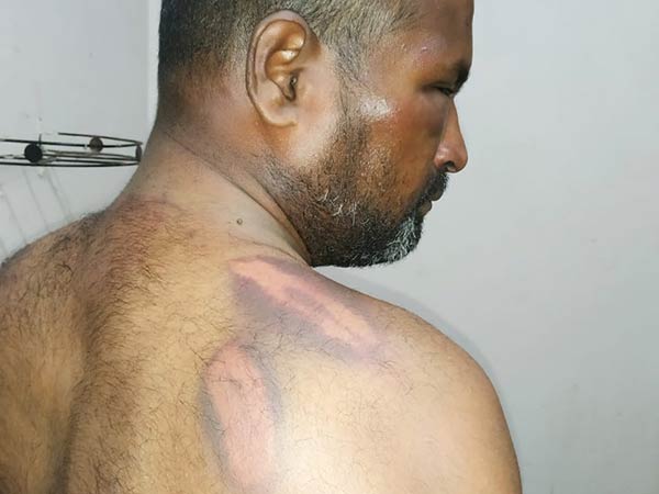 youth attacked by mlas brother youth attacked by mlas brother
