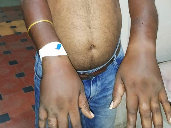 youth attacked by mlas brother youth attacked by mlas brother