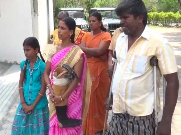 Physically Challenged person handovers his artificial leg Physically Challenged person handovers his artificial leg