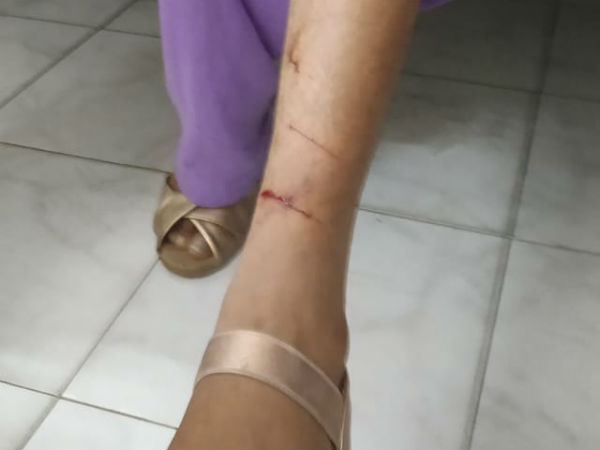 ரத்தம் வழிந்தது