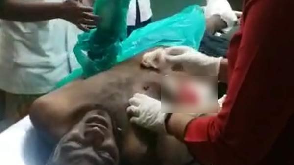 Bomb explodes in Puducherry, Rowdy Injured Bomb explodes in Puducherry, Rowdy Injured