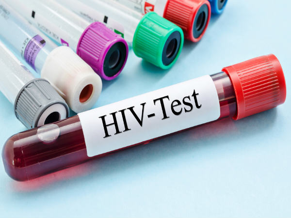 HIV Test is Compulsory before marriage In Goa HIV Test is Compulsory before marriage In Goa