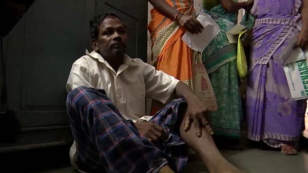 Over 30 people bitten by rabid dog..People panic in Puducherry Over 30 people bitten by rabid dog..People panic in Puducherry