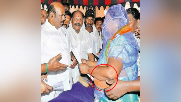 BJP member came with mosquito web on head and meet minister BJP member came with mosquito web on head and meet minister