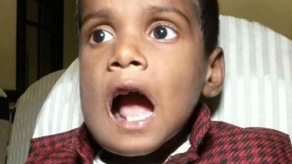 526 teeth 7 year old boys in mouth and doctors removed them 526 teeth 7 year old boys in mouth and doctors removed them