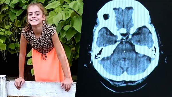 10 years old texas girl died after contracting brain eatiog amoeba 10 years old texas girl died after contracting brain eatiog amoeba