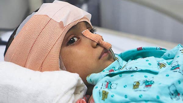 Help Drishti, Who Is Slowly Losing Her Eyesight due to tumor Help Drishti, Who Is Slowly Losing Her Eyesight due to tumor
