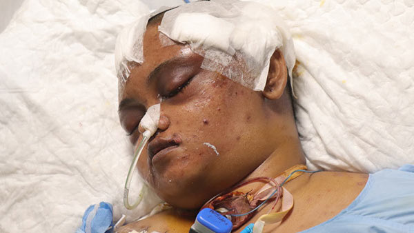 You can save Mahalakshmi who is under treatment in ICU after met with a tragic accident You can save Mahalakshmi who is under treatment in ICU after met with a tragic accident