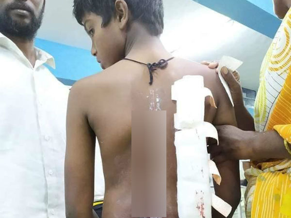 அலறல்