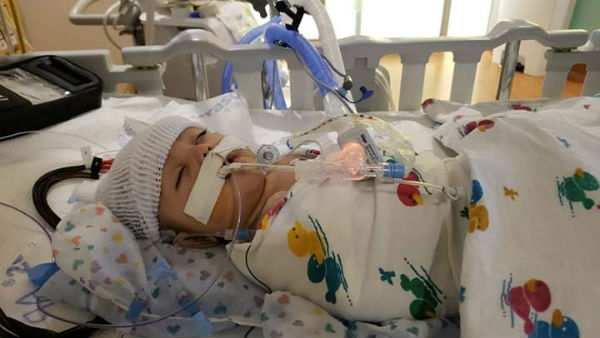 help this one year old kid get his liver transplant treatment as soon as possible help this one year old kid get his liver transplant treatment as soon as possible