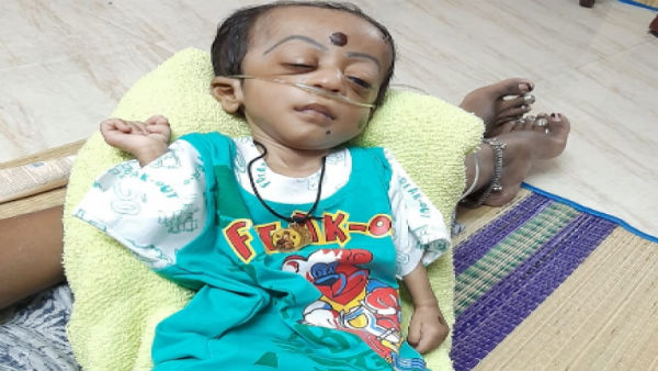 Help to save my 6 month old Baby From Glaucoma Help to save my 6 month old Baby From Glaucoma