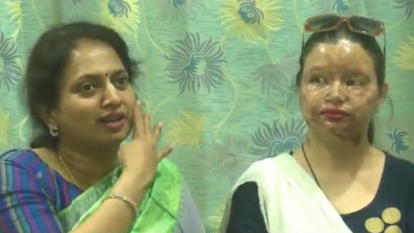 முகத்தில் ஆசிட் வீச்சு