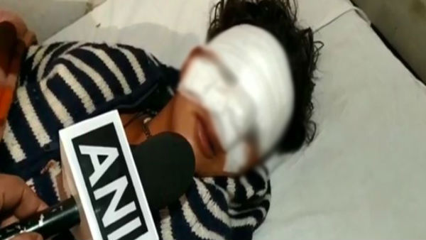 drunkard man chops off sister in laws nose in up drunkard man chops off sister in laws nose in up