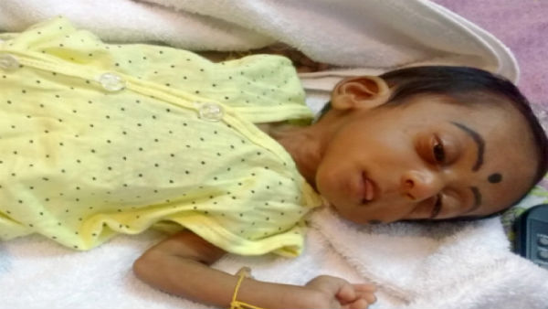 Help to save my 6 month old Baby From Glaucoma Help to save my 6 month old Baby From Glaucoma