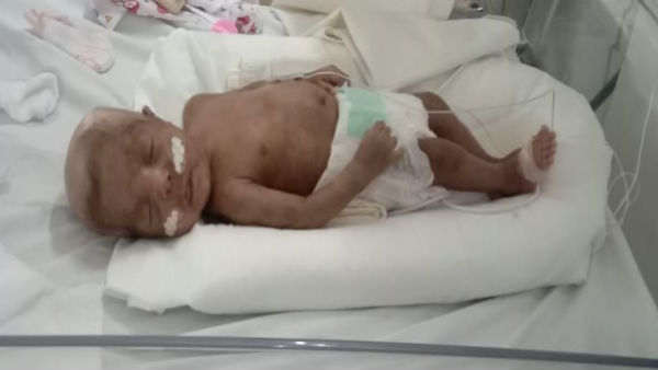 We Lost one baby already help us to save my another baby We Lost one baby already help us to save my another baby