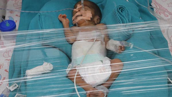 We Lost one baby already help us to save my another baby We Lost one baby already help us to save my another baby