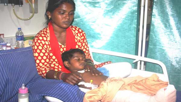 Help to save 11/2 year old boy leg crushed in accident Help to save 11/2 year old boy leg crushed in accident