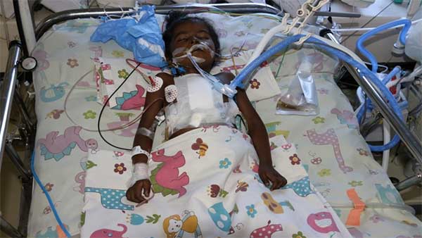 Help to save 5 year old Prathiksha from congenital heart Disease Help to save 5 year old Prathiksha from congenital heart Disease