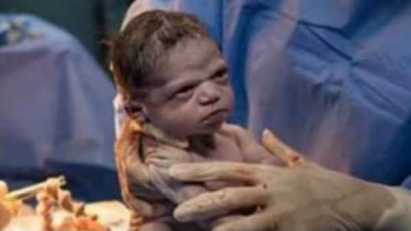 கண்களில் கோபம்