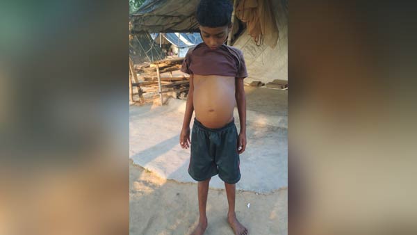 Help 7 year old Teejeesh Liver Transplant operation Help 7 year old Teejeesh Liver Transplant operation