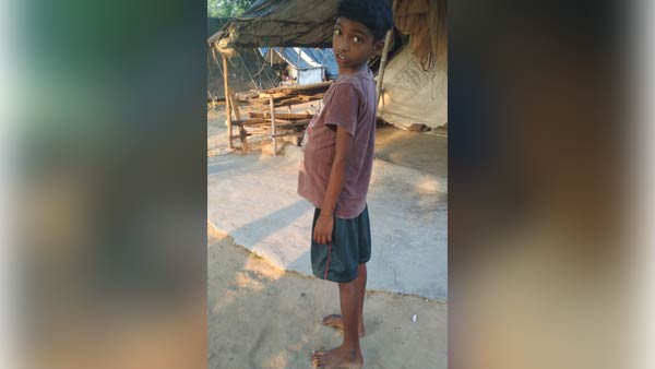 Help 7 year old Teejeesh Liver Transplant operation Help 7 year old Teejeesh Liver Transplant operation