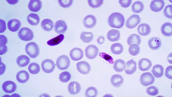 Plasmodium falciparum Plasmodium falciparum