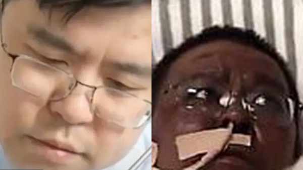 chinese doctor Hu Weifeng dies due to coronavirus chinese doctor Hu Weifeng dies due to coronavirus