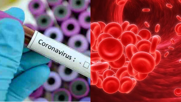 Is Clotting of Blood Main Culprit for Covid-19 Deaths? Is Clotting of Blood Main Culprit for Covid-19 Deaths?