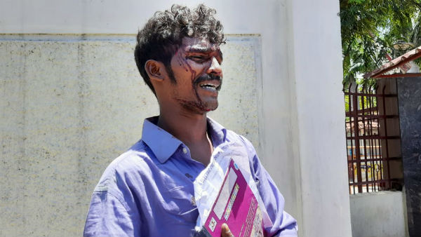 The person who went to the kovai commissioners office with injuries The person who went to the kovai commissioners office with injuries