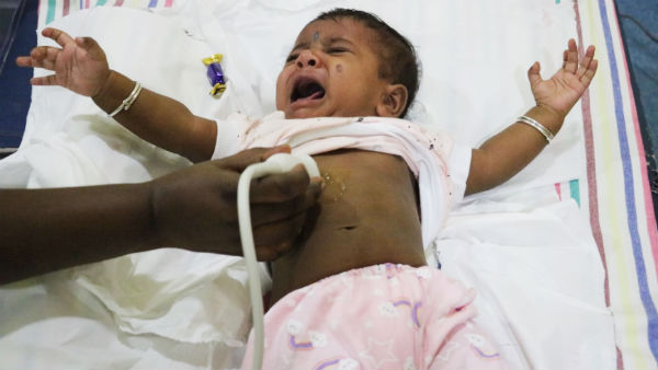 8 Month old baby Yazhnila need urgent open heart surgery to recover from heart problem 8 Month old baby Yazhnila need urgent open heart surgery to recover from heart problem