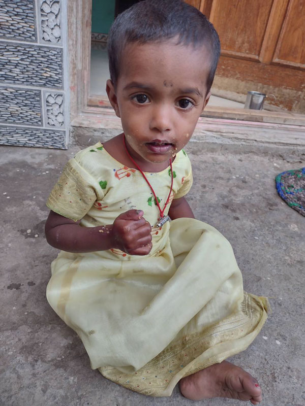Help to save 1 year old Thanushree from serious Heart problem Help to save 1 year old Thanushree from serious Heart problem