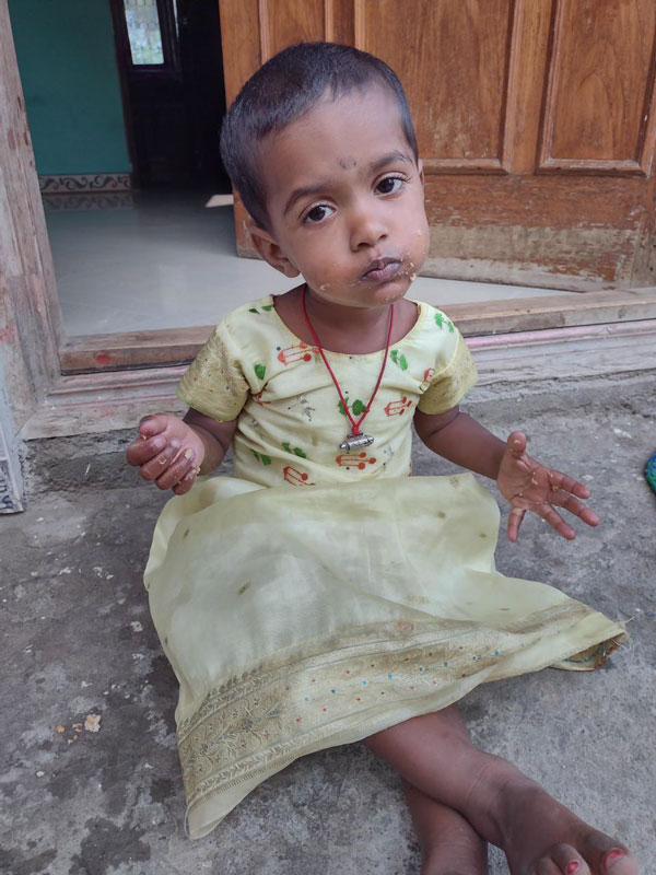 Help to save 1 year old Thanushree from serious Heart problem Help to save 1 year old Thanushree from serious Heart problem