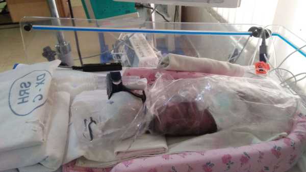 4 weeks old premature baby need your support to survive 4 weeks old premature baby need your support to survive