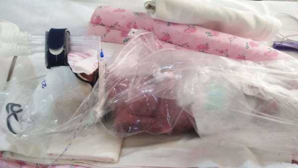 4 weeks old premature baby need your support to survive 4 weeks old premature baby need your support to survive