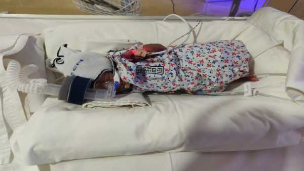 4 weeks old premature baby need your support to survive 4 weeks old premature baby need your support to survive