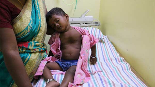 Help 2 year brindha recover from heart problem Help 2 year brindha recover from heart problem