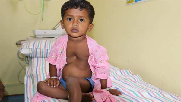 Help 2 year brindha recover from heart problem Help 2 year brindha recover from heart problem